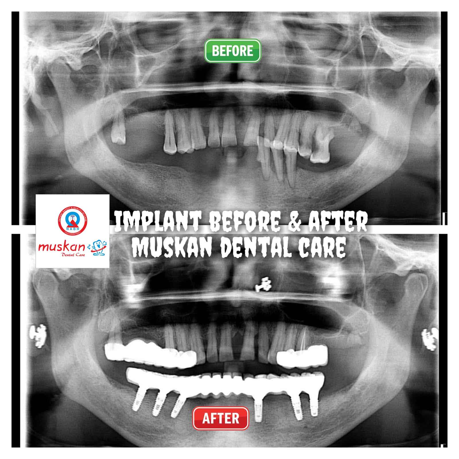muskan dental care delhi41