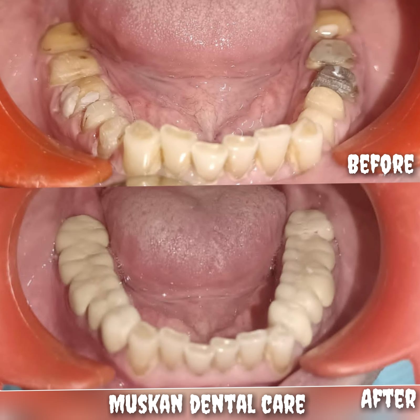 muskan dental care delhi50