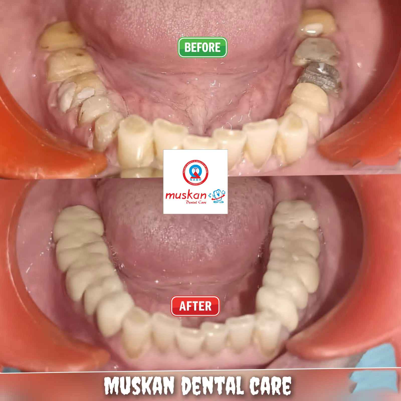 muskan dental care delhi50