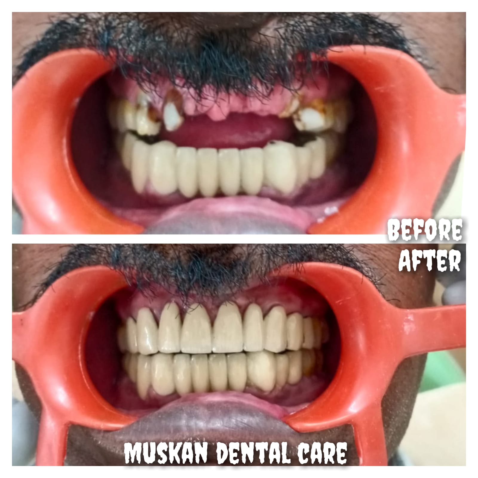 muskan dental care delhi51