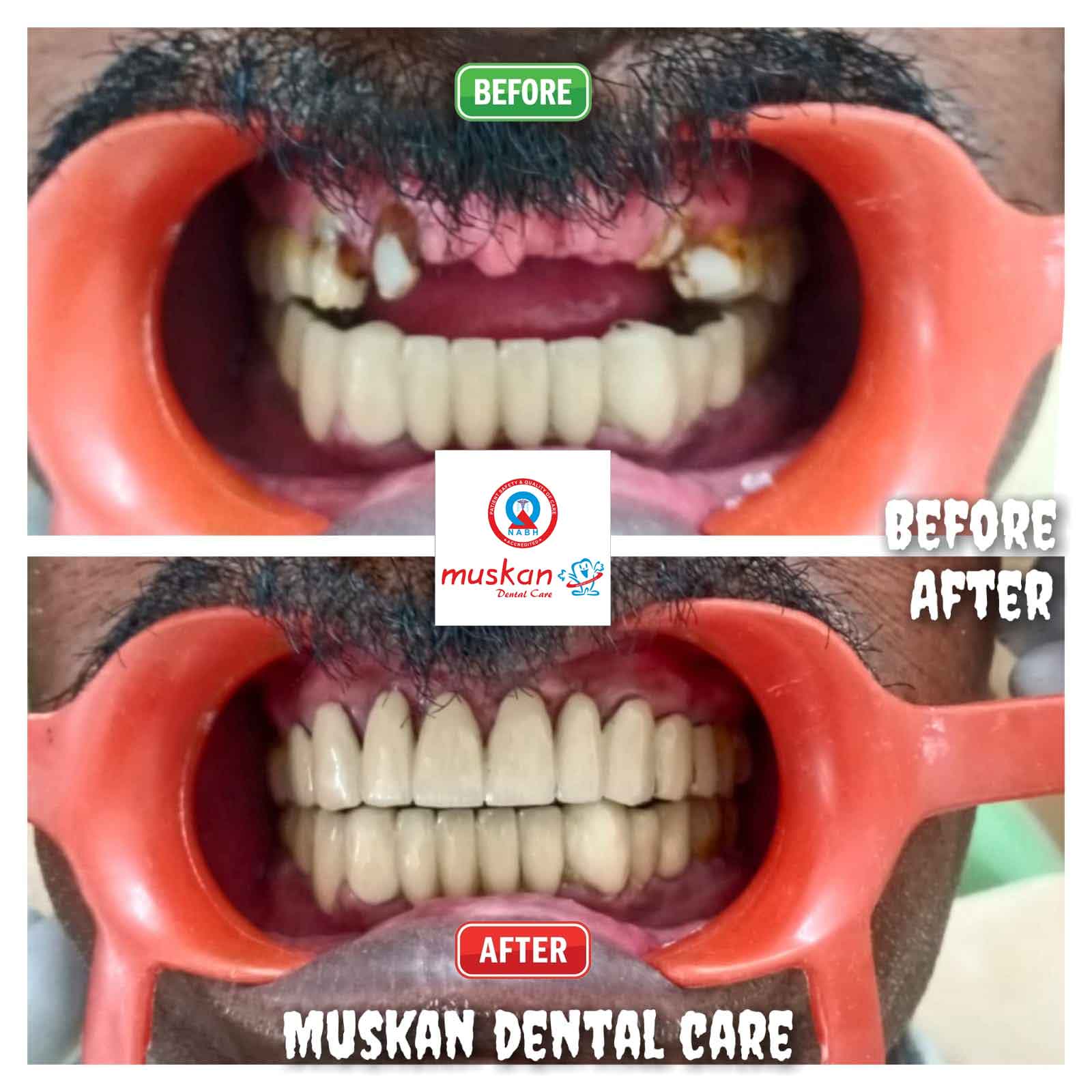 muskan dental care delhi51