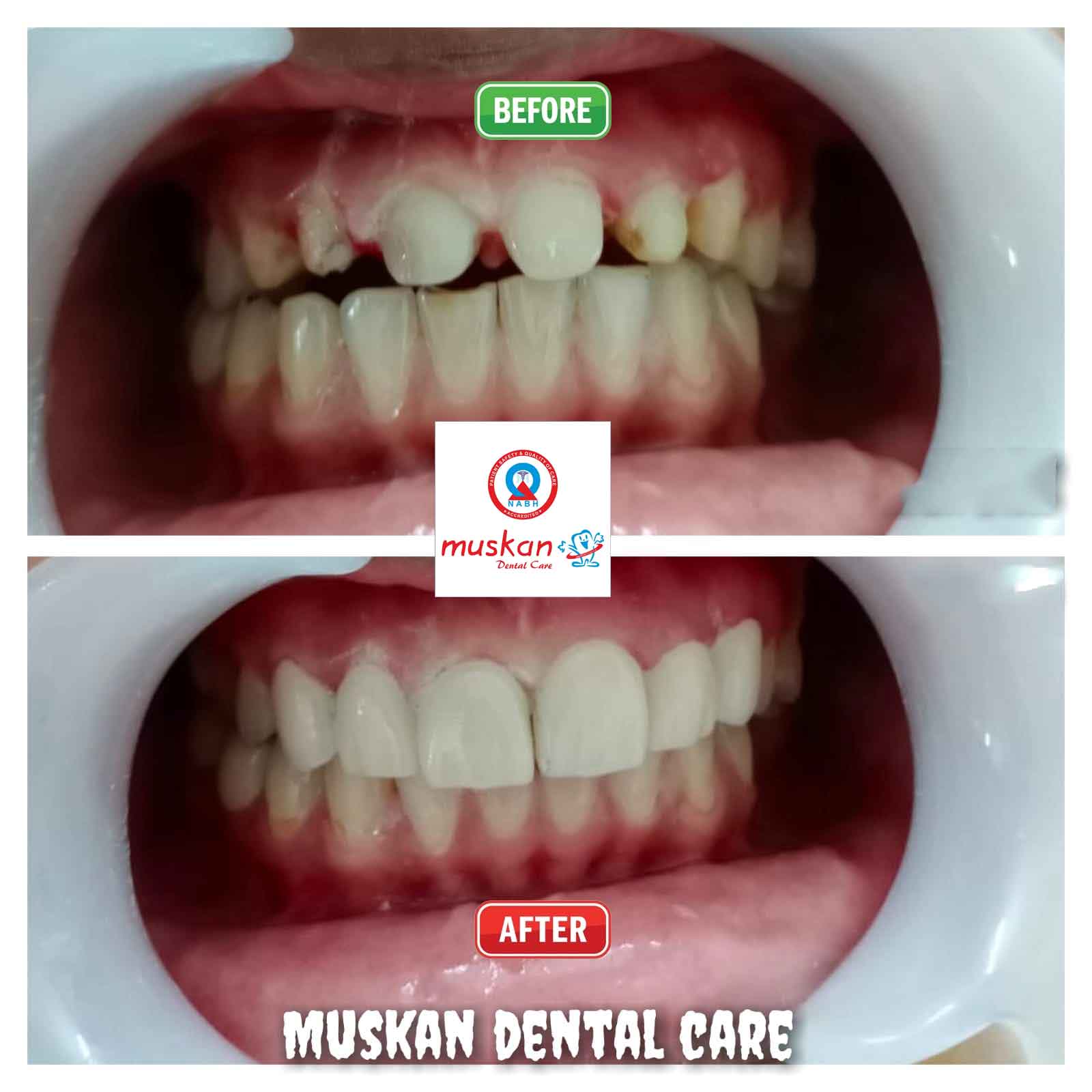 muskan dental care delhi52