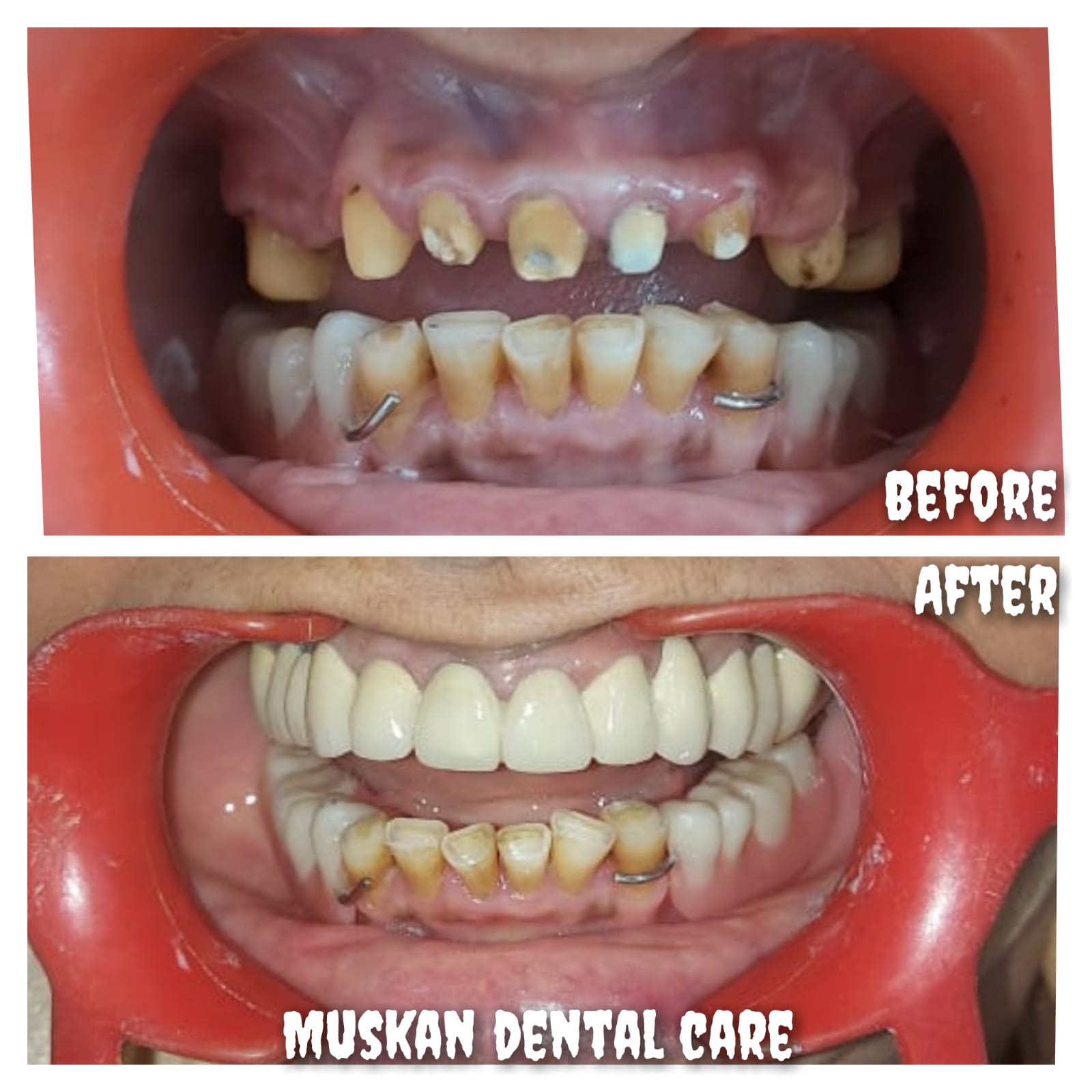 muskan dental care delhi53