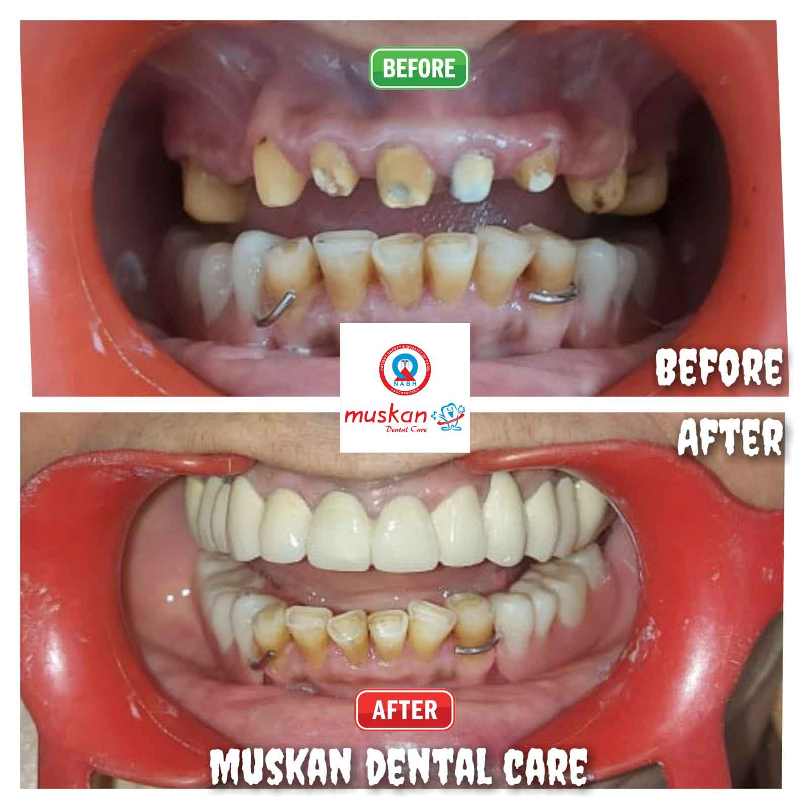 muskan dental care delhi53