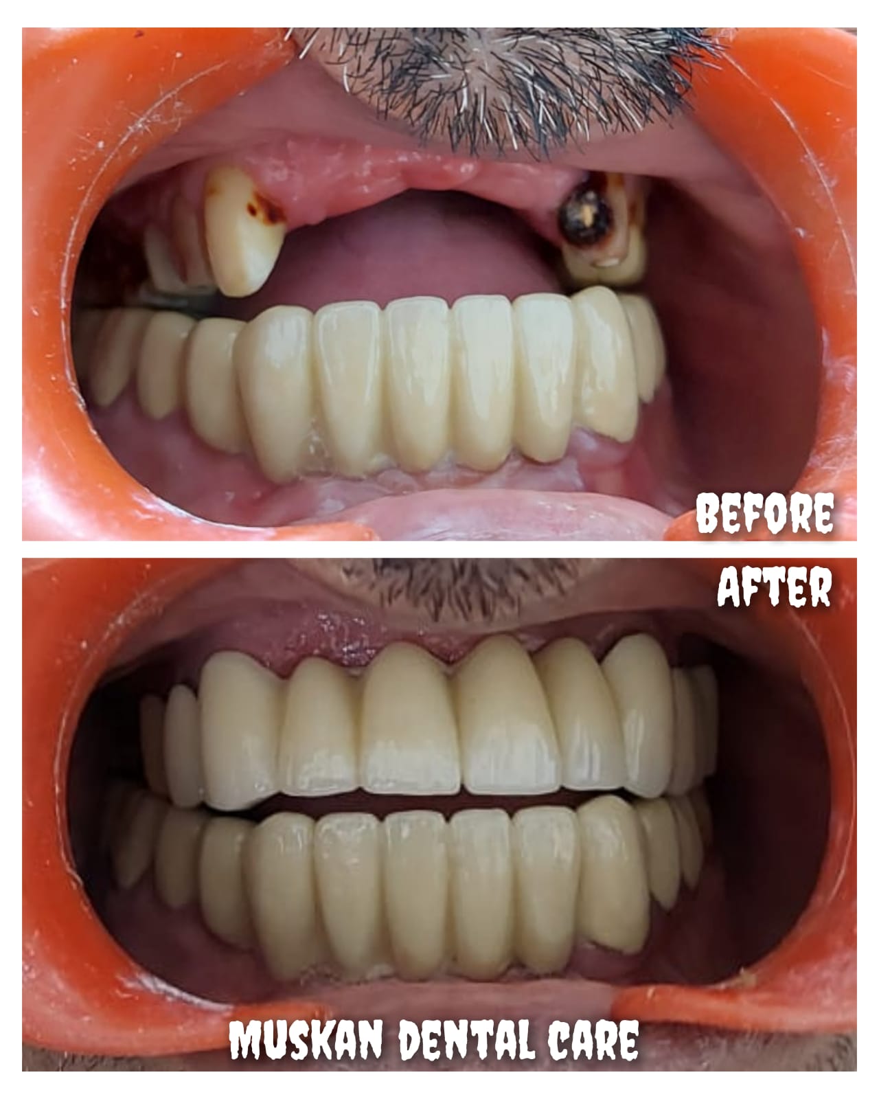 muskan dental care delhi54