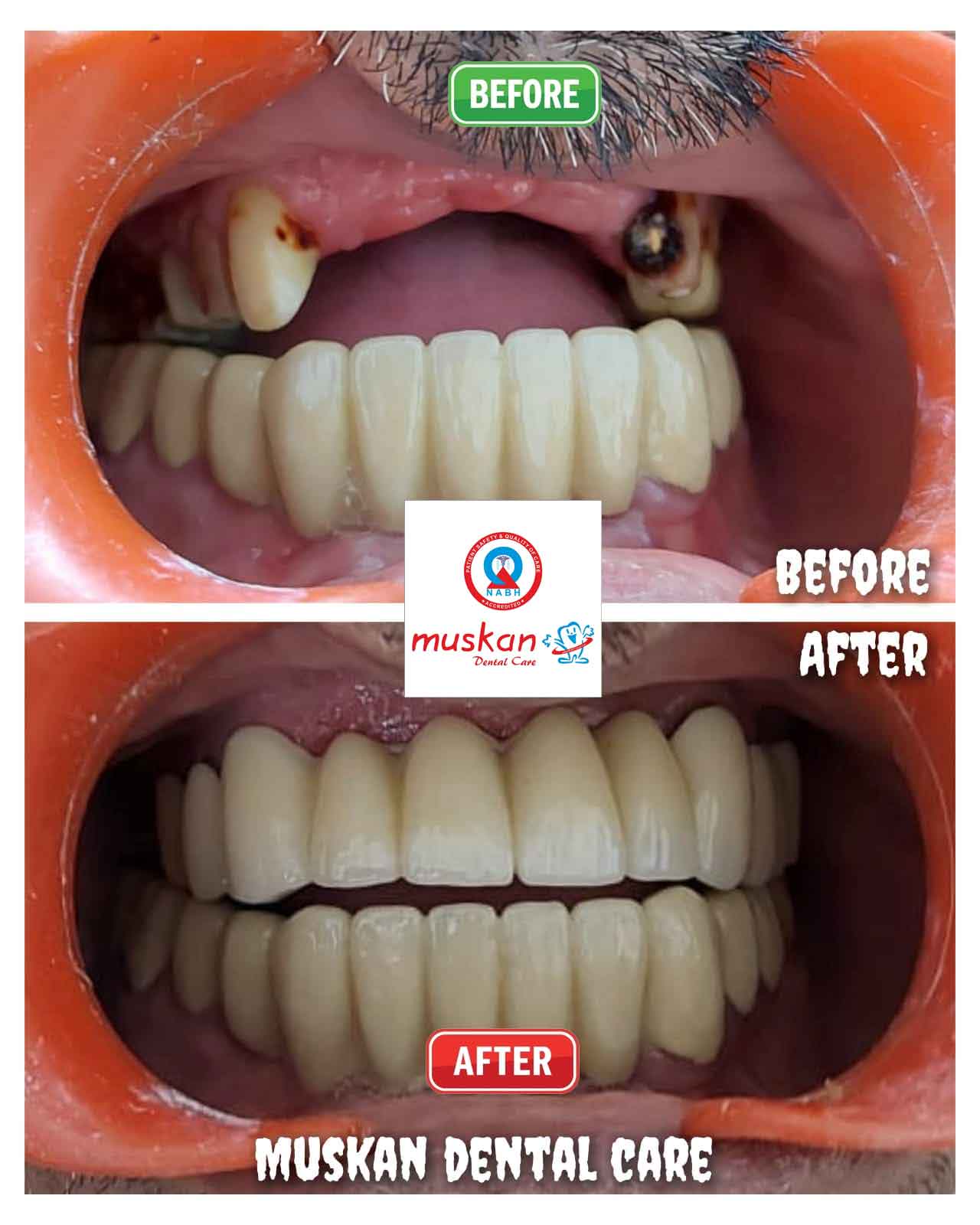 muskan dental care delhi54