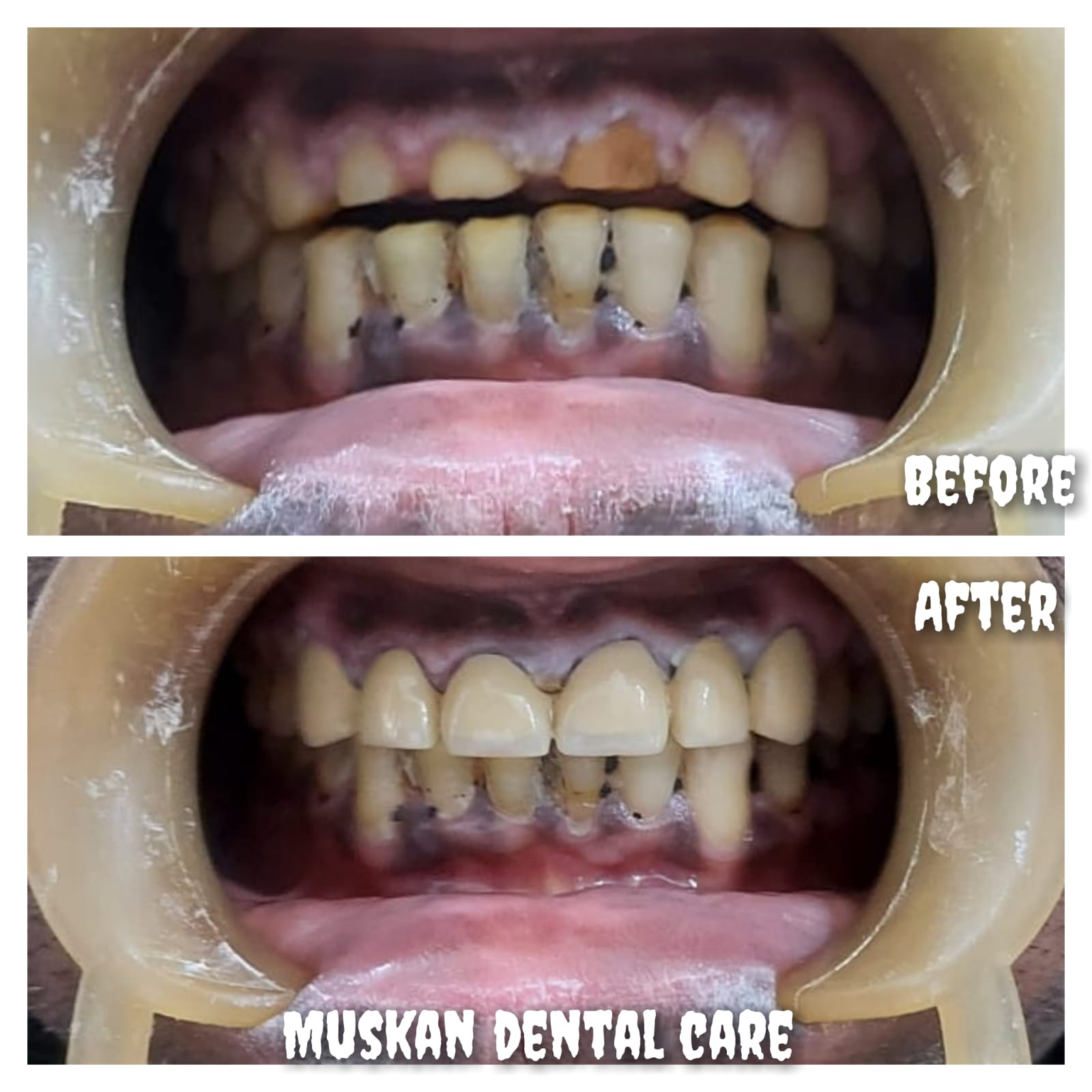 muskan dental care delhi55