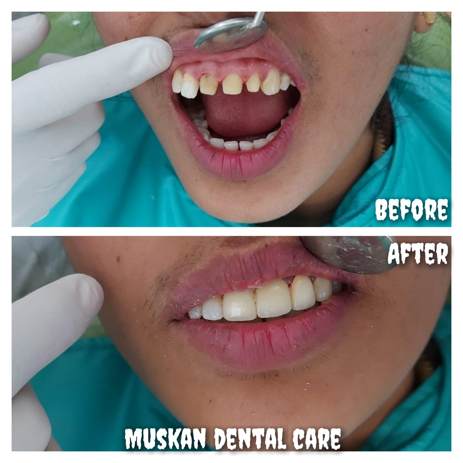 muskan dental care delhi55