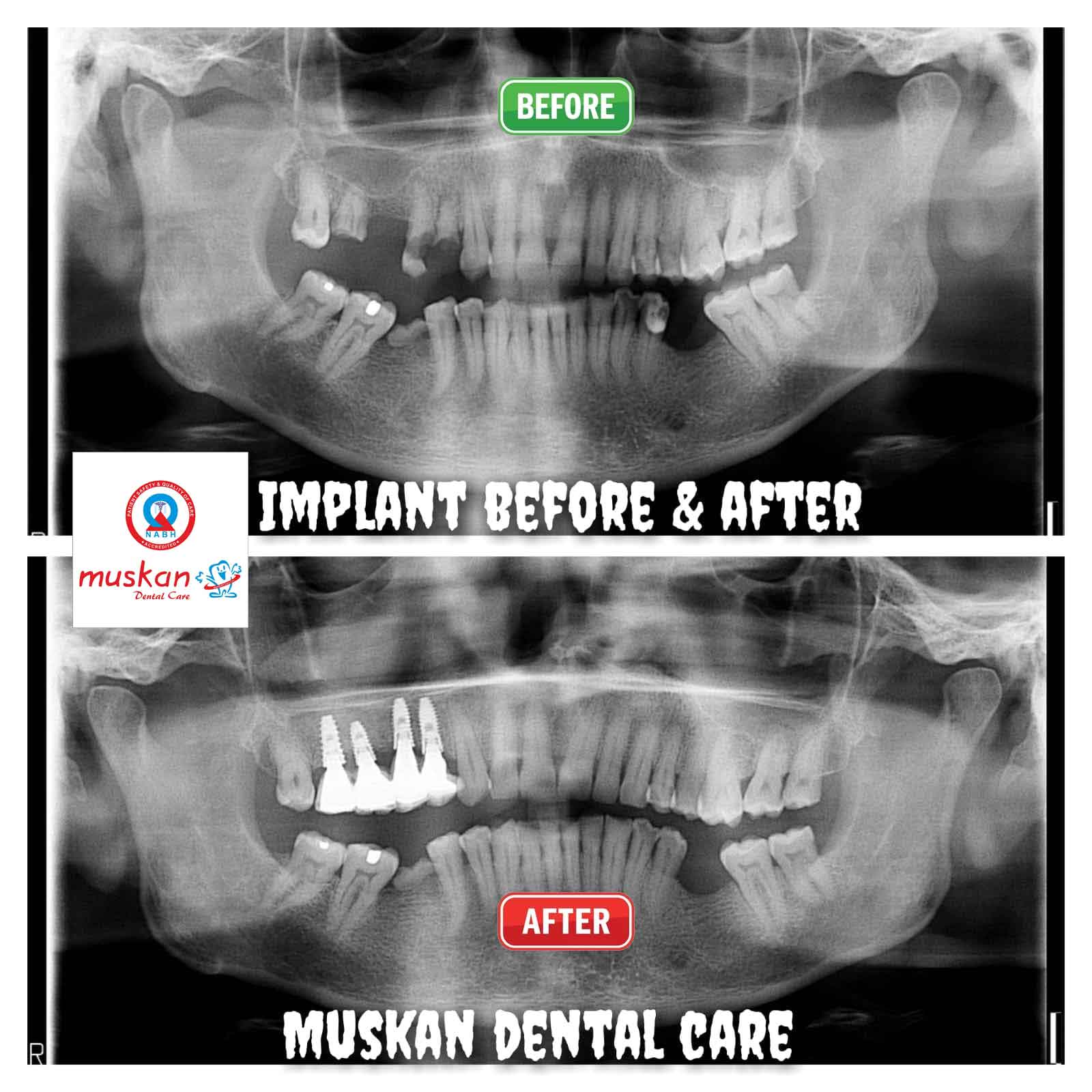 muskan dental care delhi55