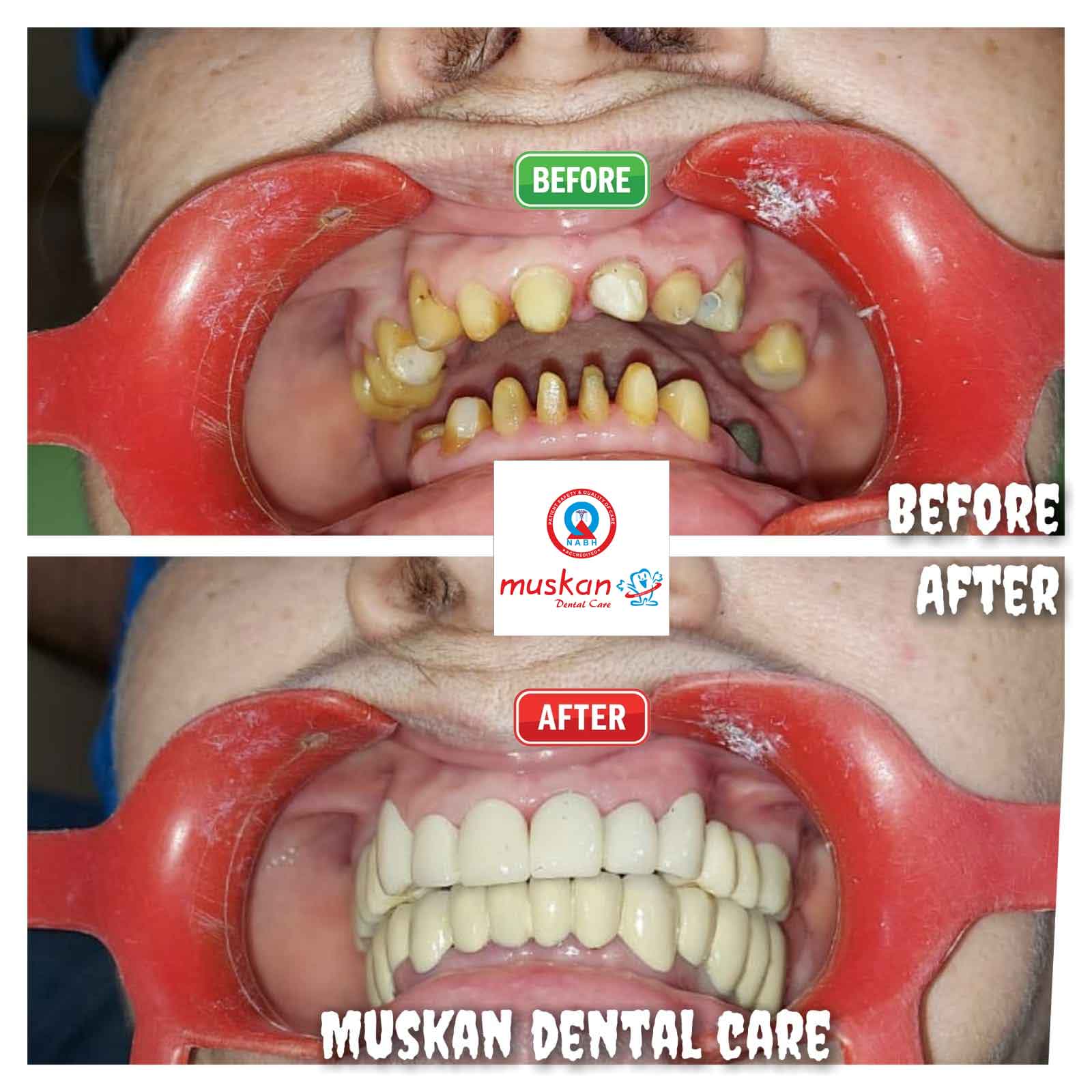muskan dental care delhi55