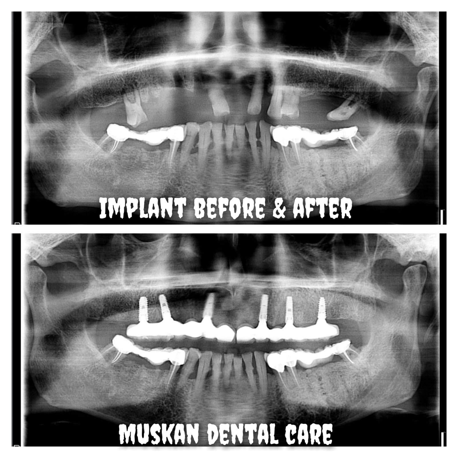 muskan dental care delhi42