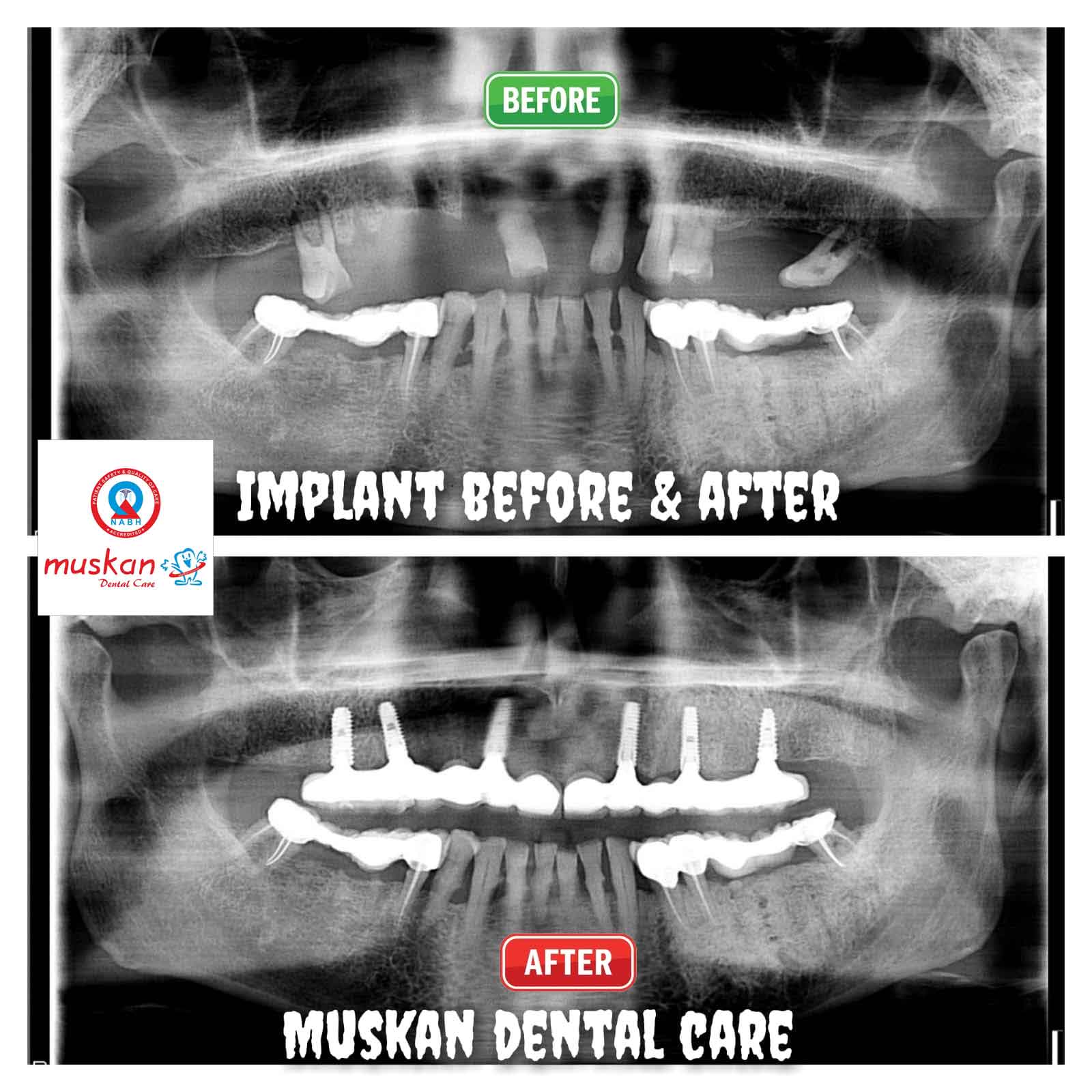 muskan dental care delhi42