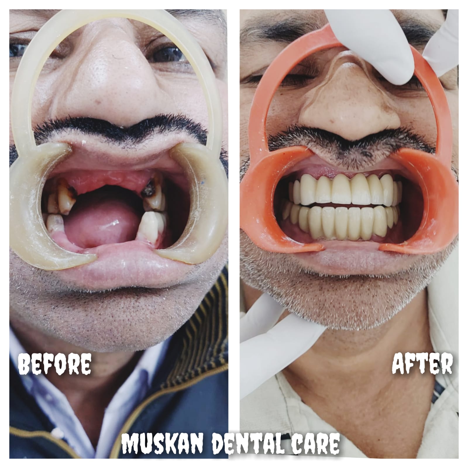 muskan dental care delhi43