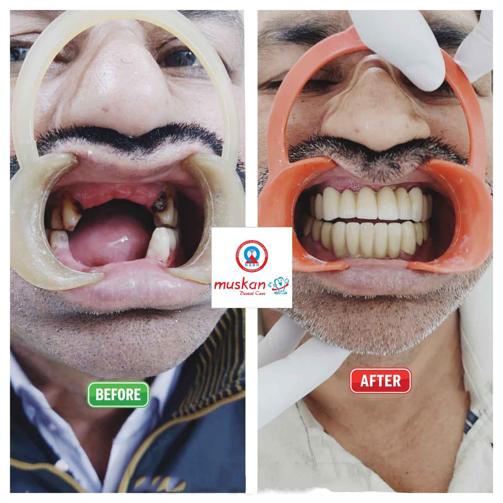 muskan dental care delhi43