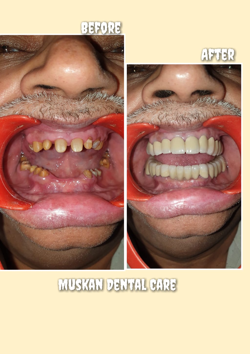 muskan dental care delhi44