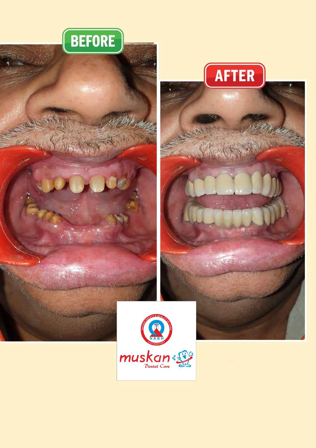 muskan dental care delhi44