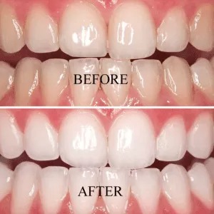 muskan dental care delhi45