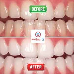 muskan dental care delhi45