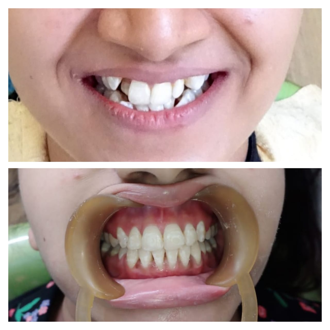 muskan dental care delhi46