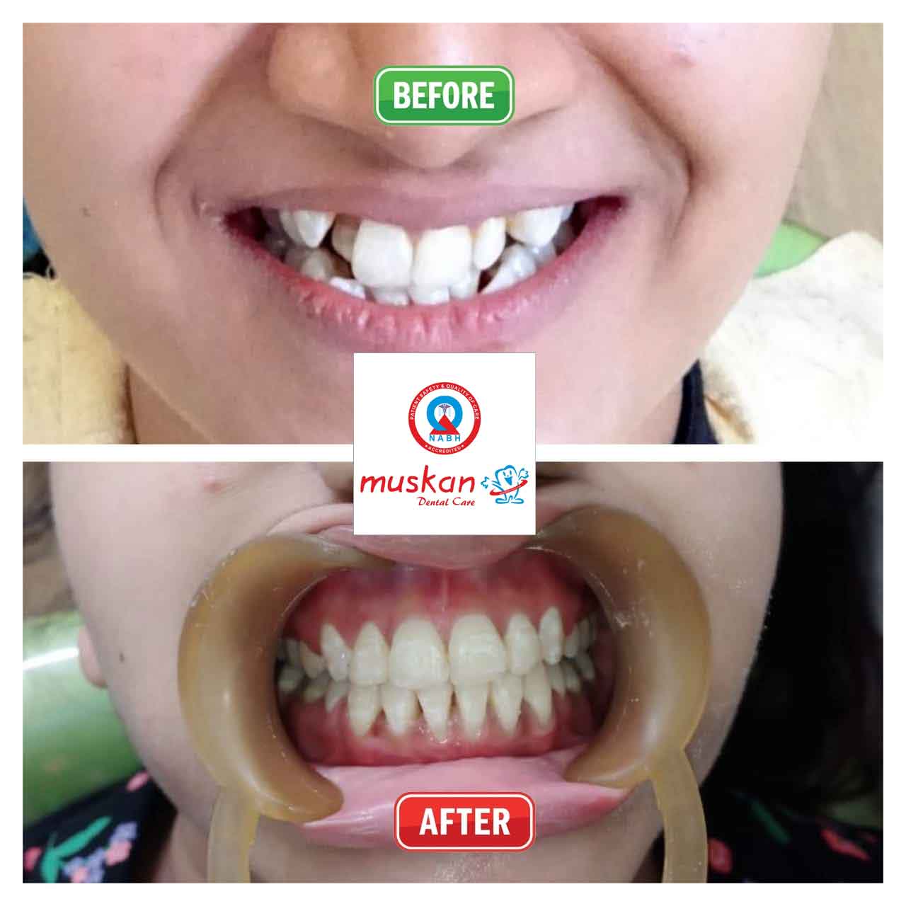 muskan dental care delhi46