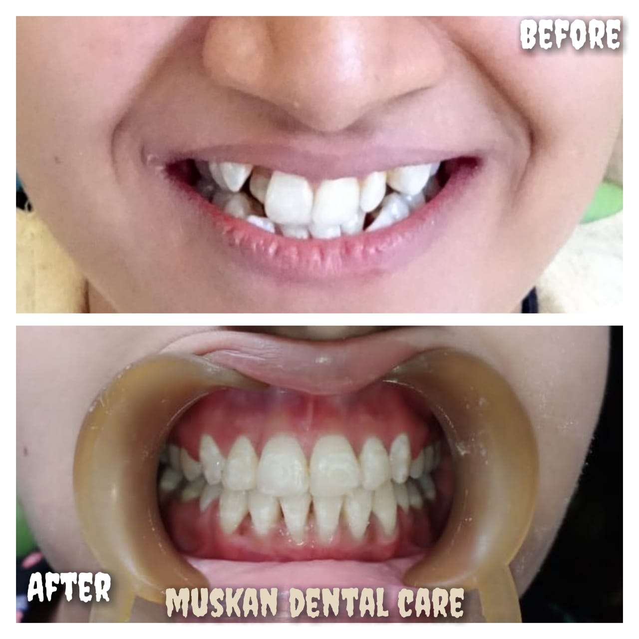 muskan dental care delhi47