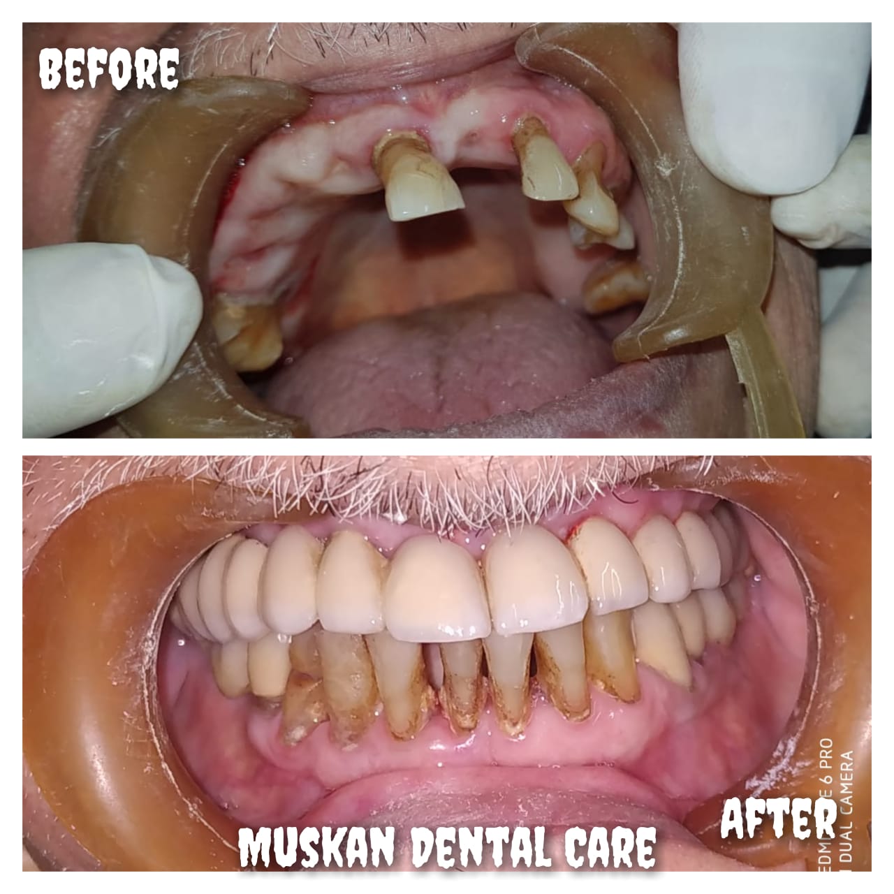 muskan dental care delhi48