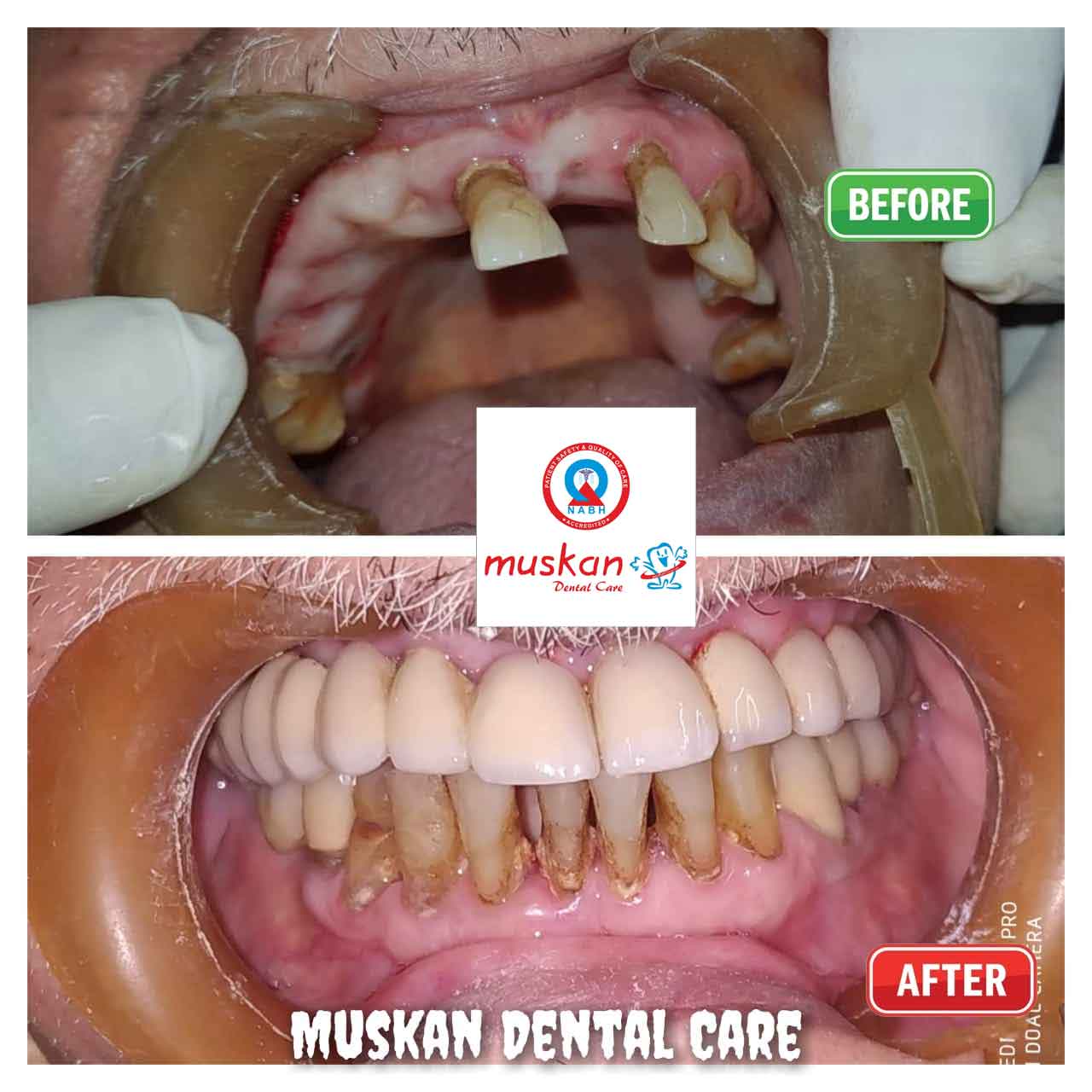 muskan dental care delhi48