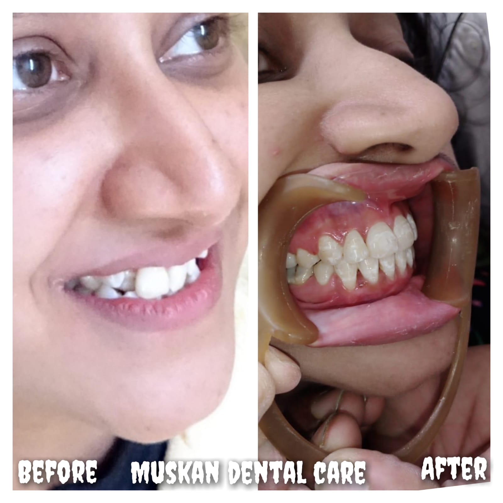 muskan dental care delhi49