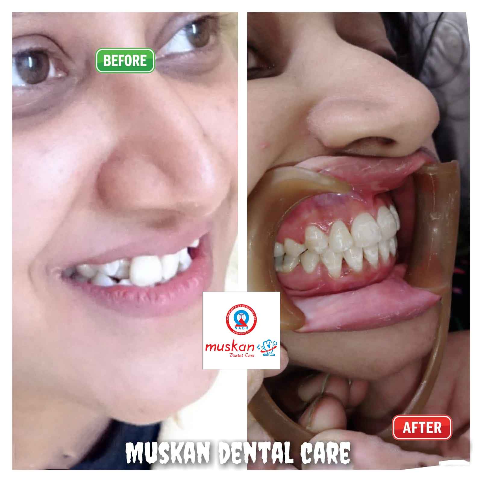 muskan dental care delhi49
