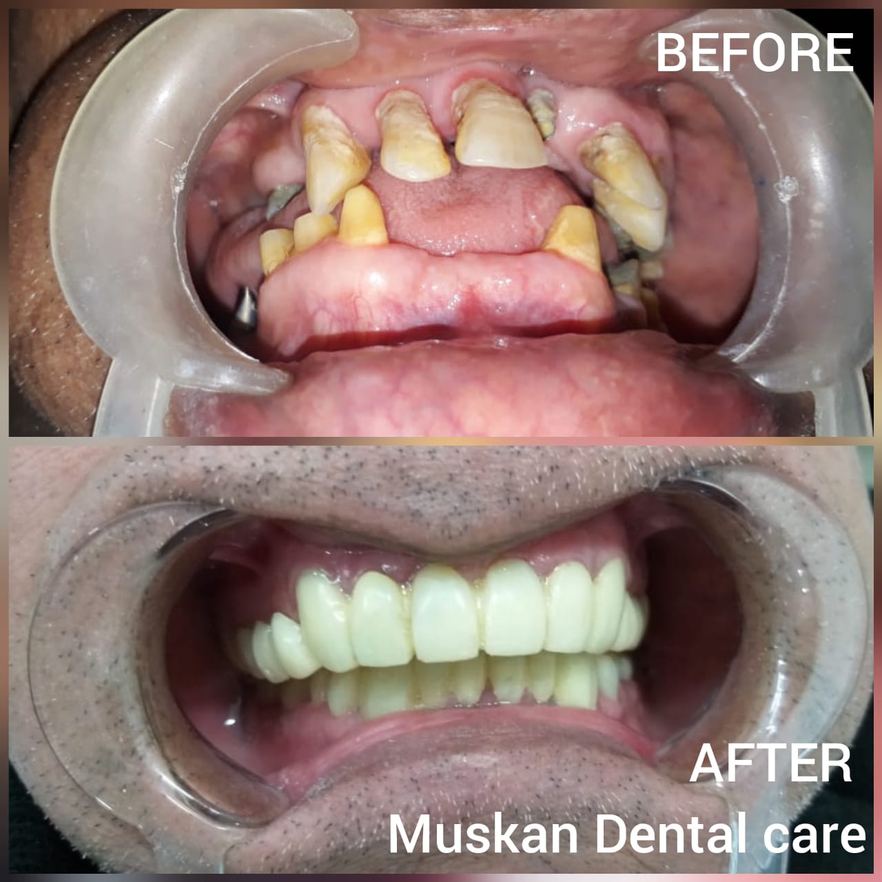 muskan dental care delhi4