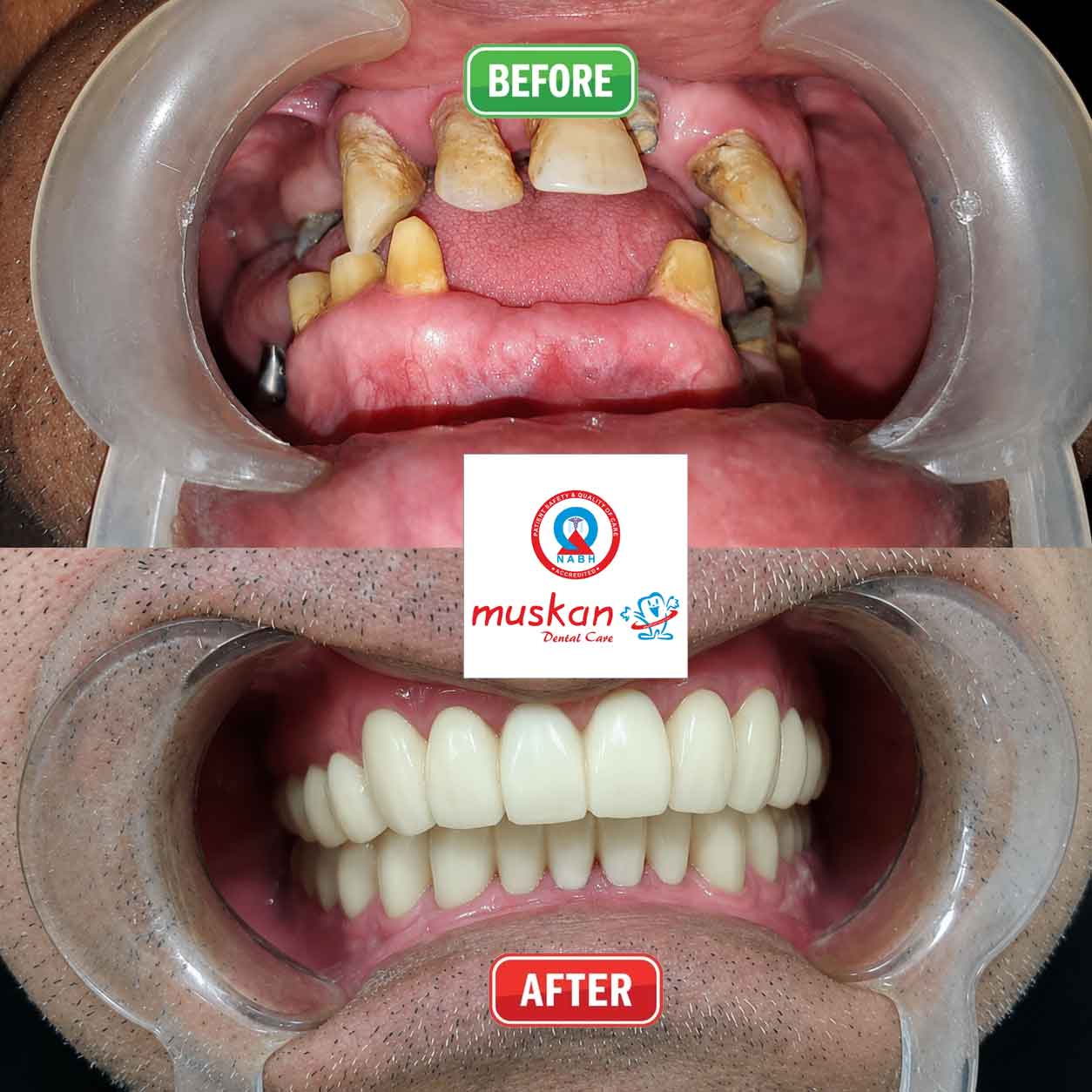 muskan dental care delhi4