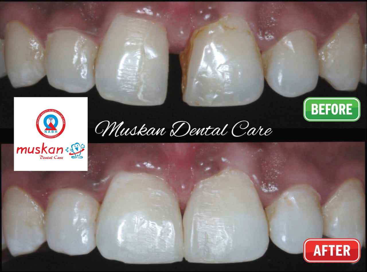 muskan dental care delhi30