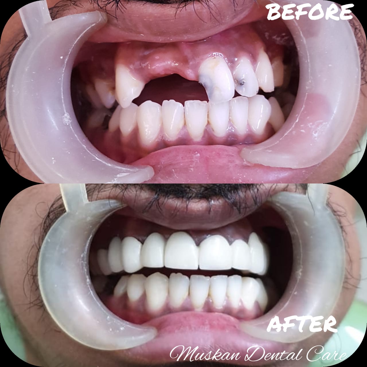 muskan dental care delhi36
