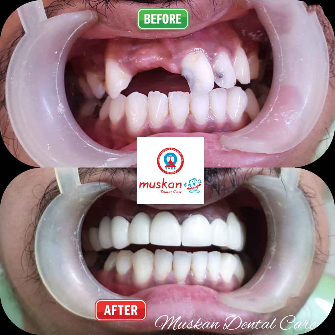 muskan dental care delhi36