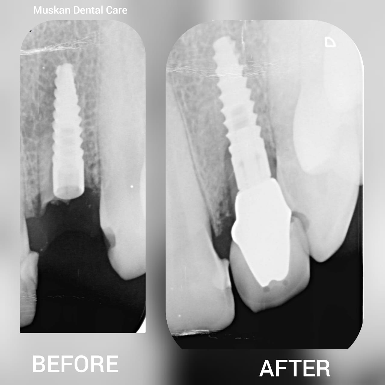 muskan dental care delhi37