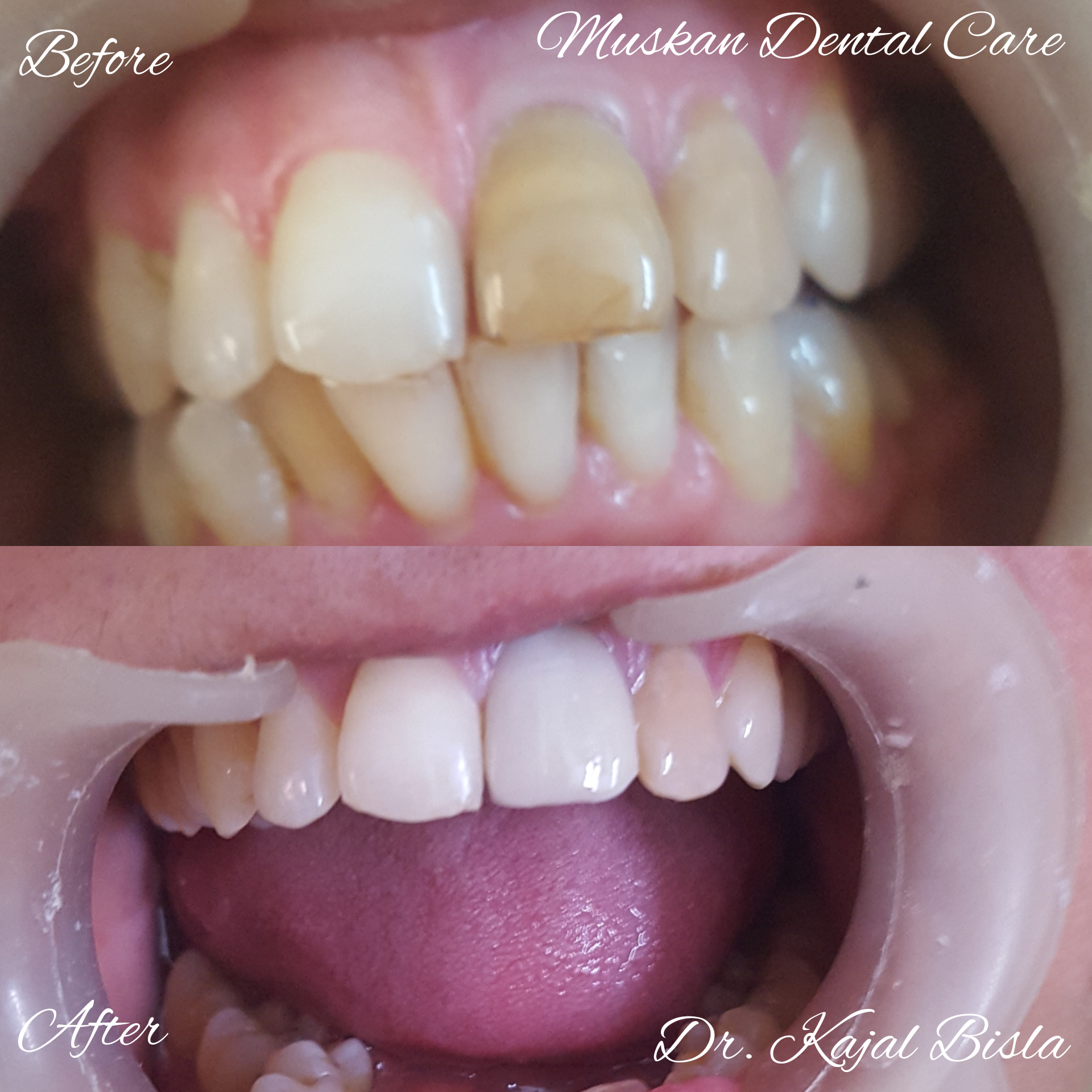 muskan dental care delhi38