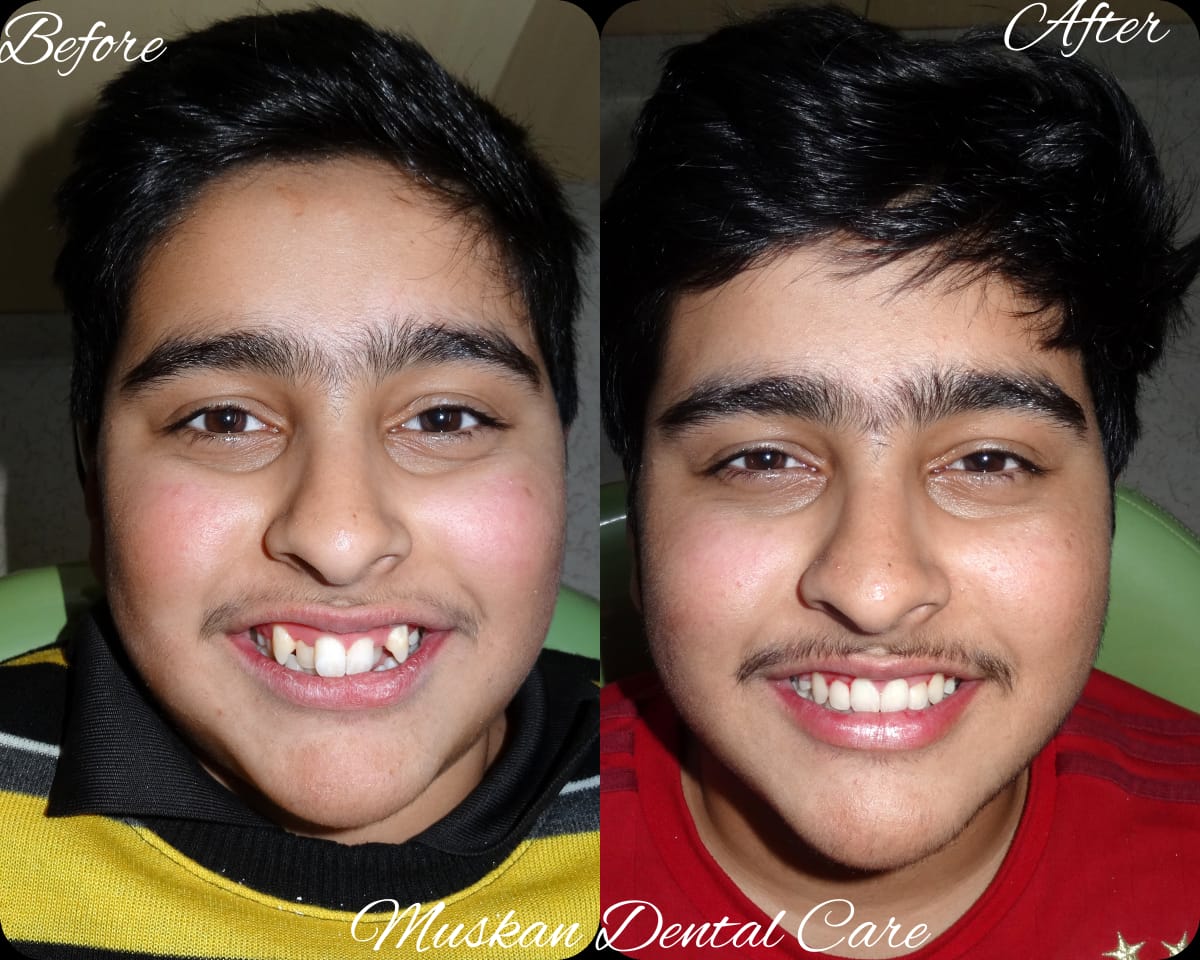 muskan dental care delhi39
