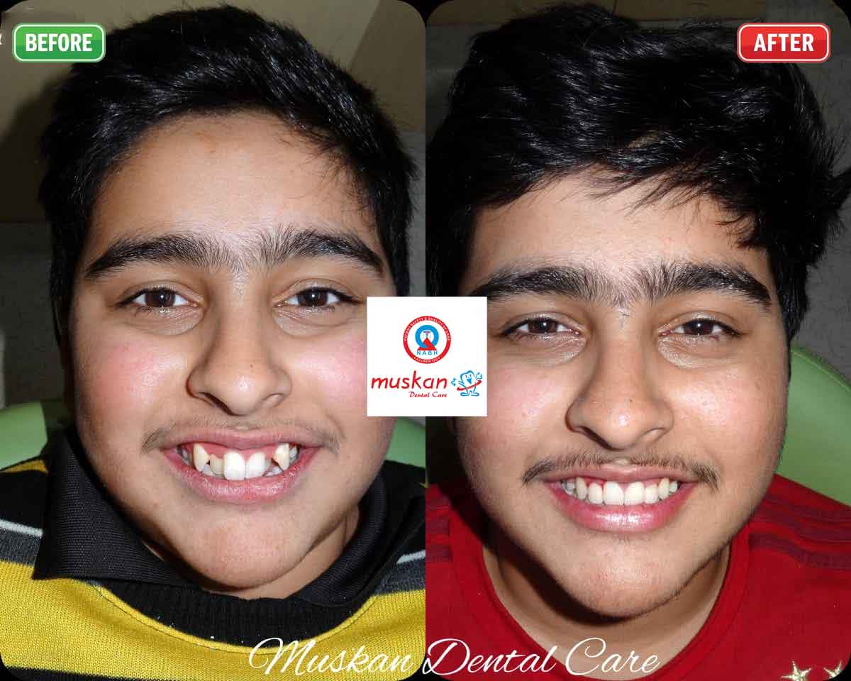 muskan dental care delhi39