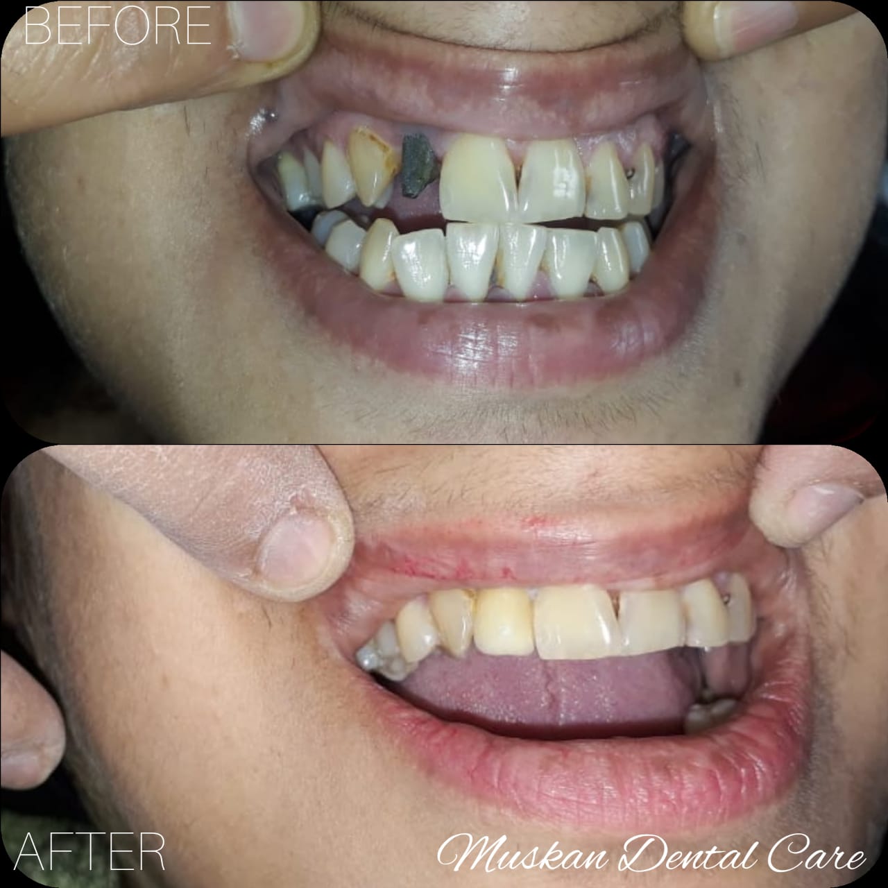 muskan dental care delhi40