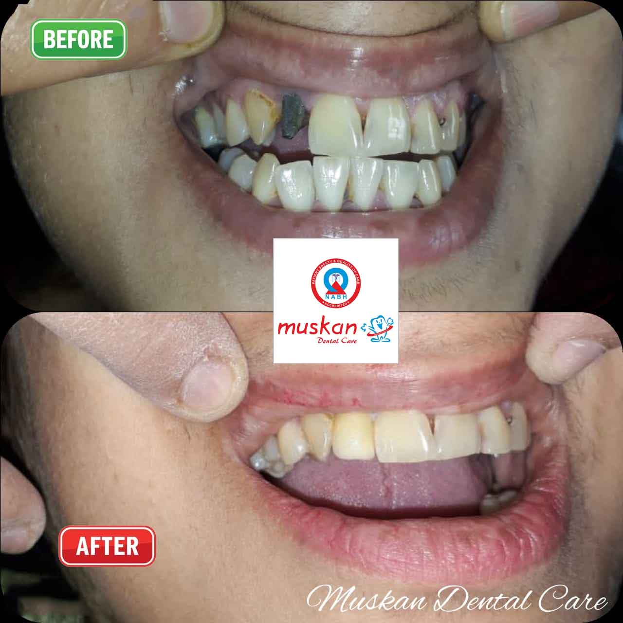 muskan dental care delhi40