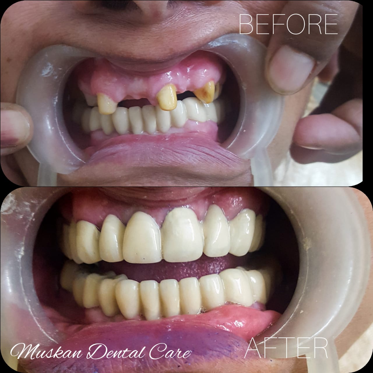 muskan dental care delhi13