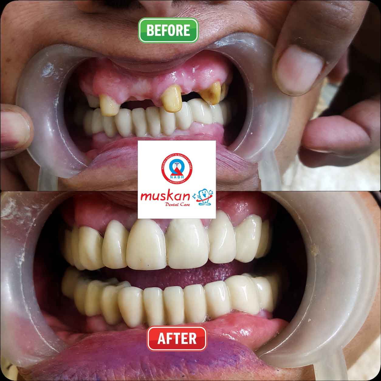 muskan dental care delhi13