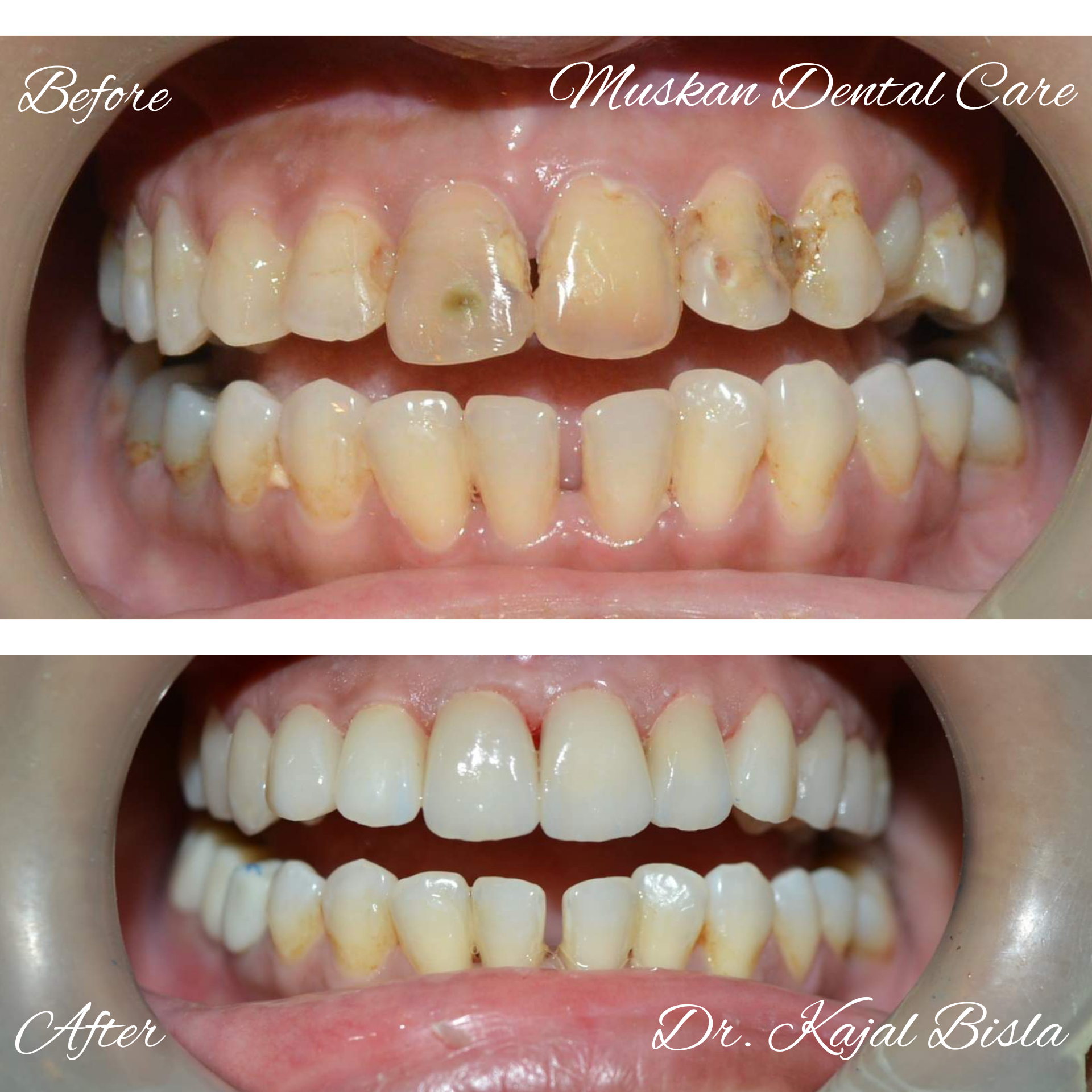 muskan dental care delhi27