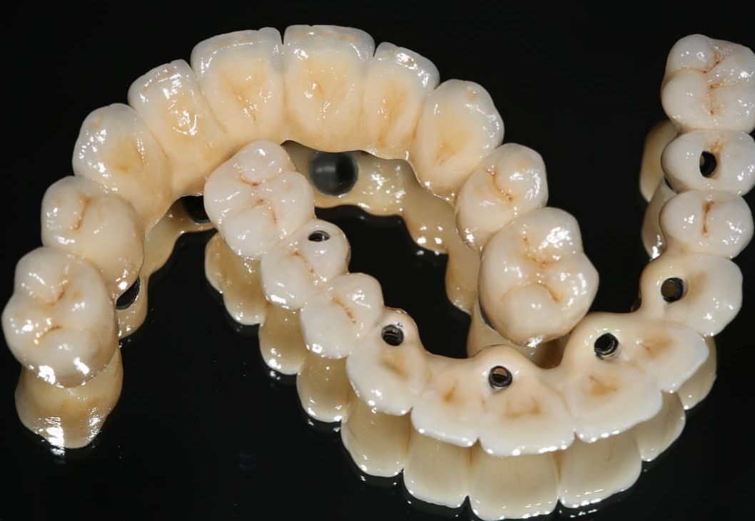 muskan dental care delhi28