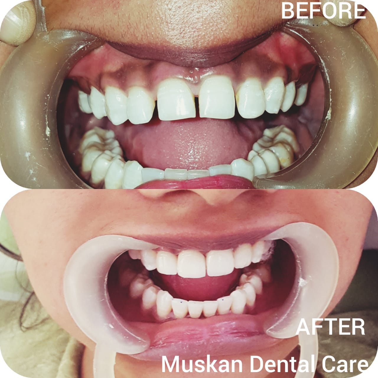 muskan dental care delhi29