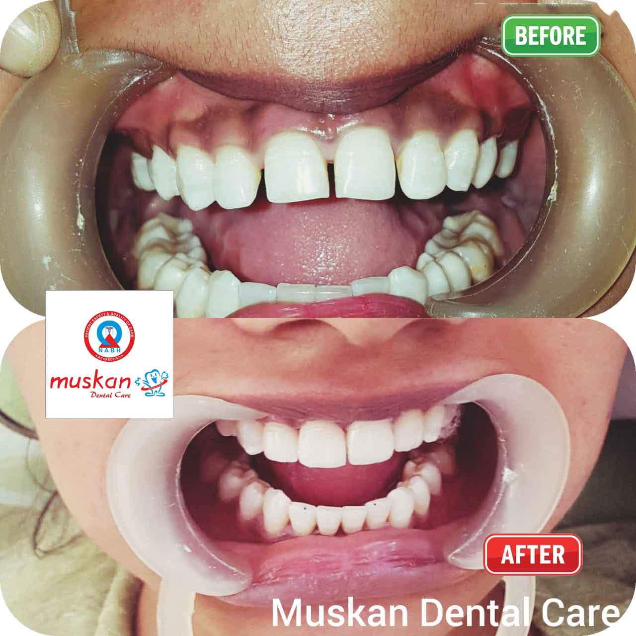 muskan dental care delhi29