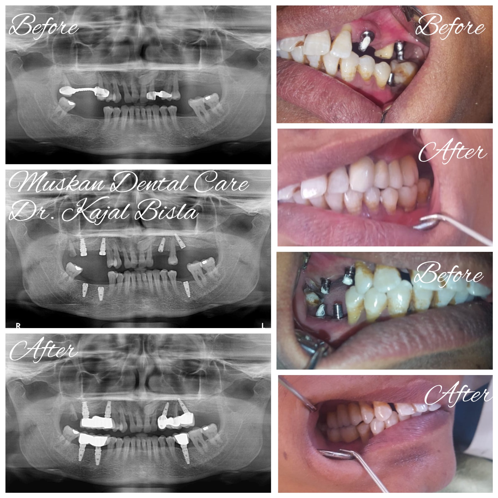 muskan dental care delhi4