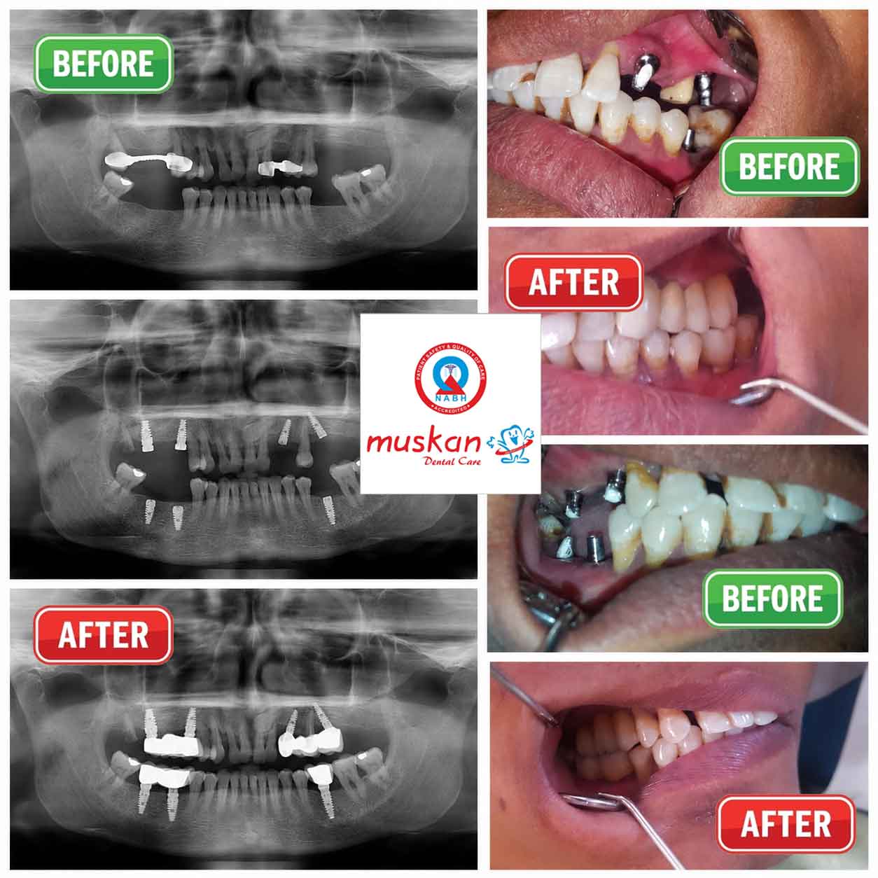 muskan dental care delhi4