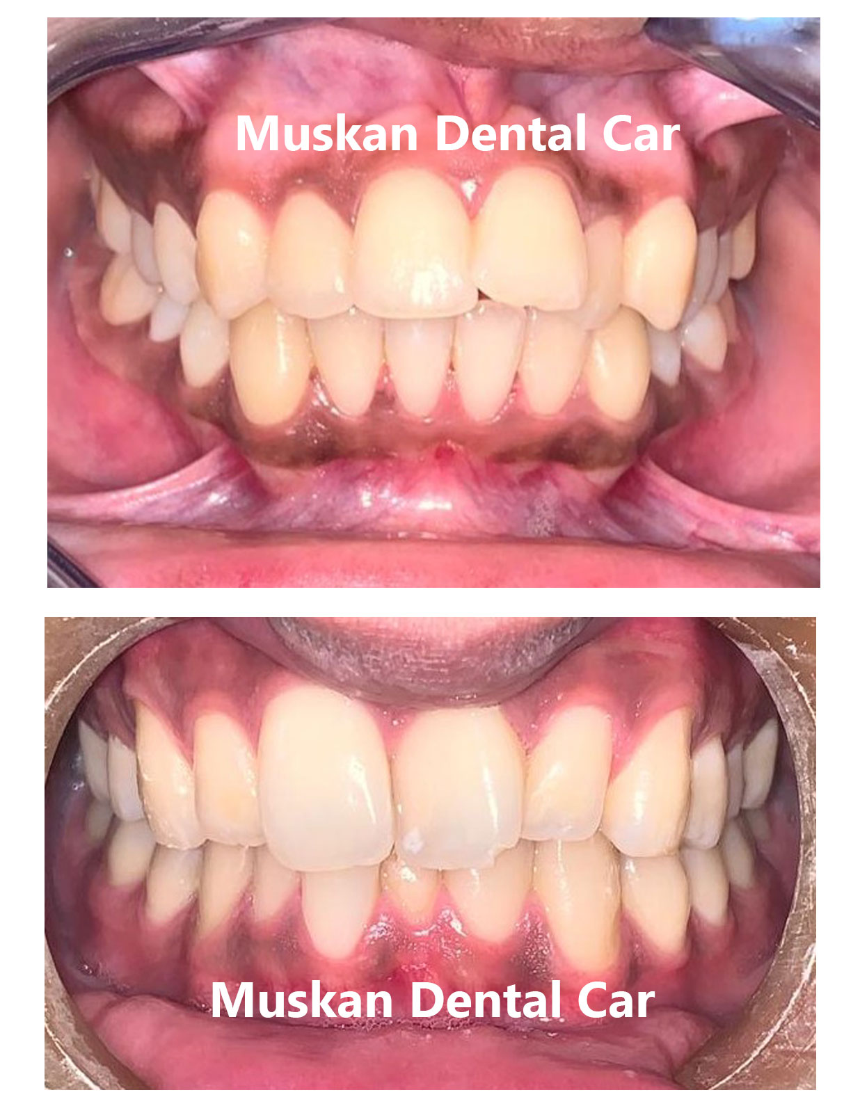 muskan dental care delhi24