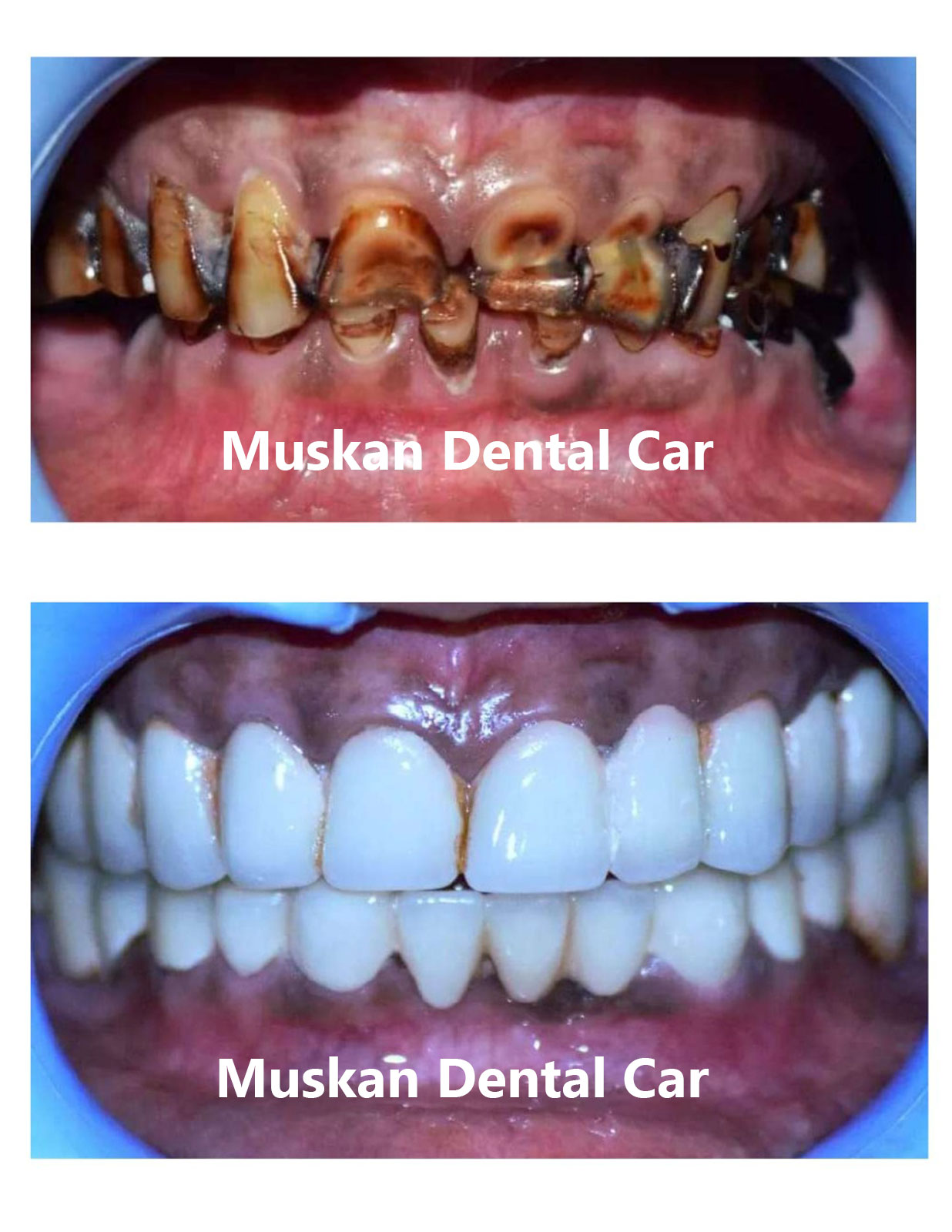 muskan dental care delhi24
